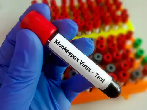 Monkeypox RT-PCR Test: A step-by-step guide for accurate results